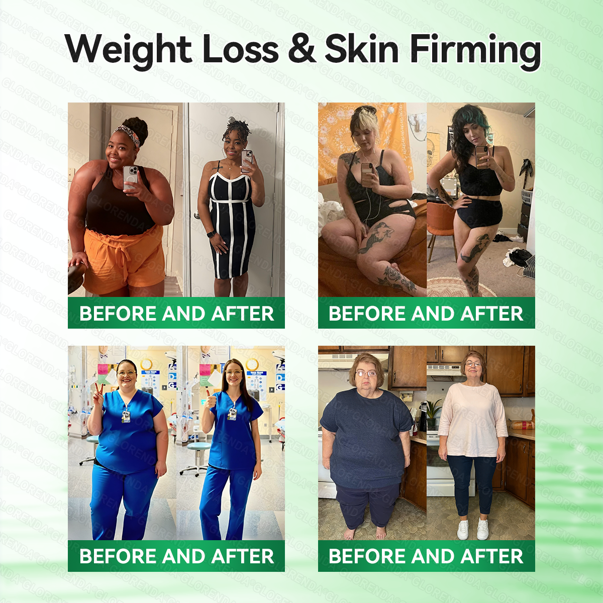 🇬🇧𝑶𝒇𝒇𝒊𝒄𝒊𝒂𝒍 𝑺𝒕𝒐𝒓𝒆  | 💚💚𝐆𝑳𝑶𝗥𝗘𝗡𝘿𝘼® 𝙈𝒐𝒓𝒊𝒏𝒈𝗮 · 𝗕𝗲𝗿𝗯𝐞𝐫𝐢𝐧𝙚 × 𝙉𝑨𝑫+ 𝟏𝟎-𝙞𝙣-1 𝘼𝒅𝒗𝒂𝒏𝒄𝒆𝐝 𝐍𝐚𝐧𝙤 𝙈𝙞𝙘𝙧𝙤𝙣𝒆𝒆𝒅𝒍𝐞 𝐏𝐚𝐭𝙘𝙝(𝐉𝐮𝐬𝐭 𝐨𝐧𝐜𝐞 𝐚 𝐝𝐚𝐲, 𝐯𝐢𝐬𝐢𝐛𝐥𝐞 𝐜𝐡𝐚𝐧𝐠𝐞𝐬 𝐢𝐧 𝟕 𝐝𝐚𝐲𝐬） ✅ 𝐅𝐨𝐫 𝐨𝐛𝐞𝐬𝐢𝐭𝐲, 🅛🅞🅞🅢🅔 🅢🅚🅘🅝,𝐝𝐢𝐚𝐛𝐞𝐭𝐞𝐬, 𝐬𝐥𝐞𝐞𝐩 𝐚𝐩𝐧𝐞𝐚, 𝐣𝐨𝐢𝐧𝐭 𝐢𝐬𝐬𝐮𝐞𝐬, 𝐚𝐧𝐝 𝐦𝐨𝐫𝐞