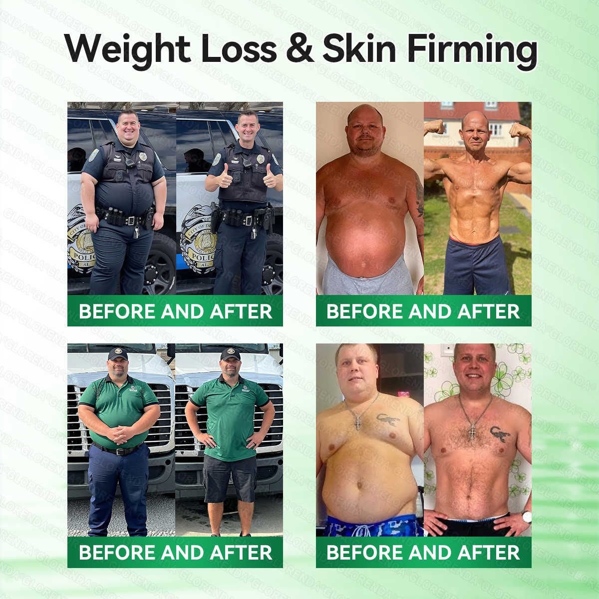 🇬🇧𝑶𝒇𝒇𝒊𝒄𝒊𝒂𝒍 𝑺𝒕𝒐𝒓𝒆  | 💚💚𝐆𝑳𝑶𝗥𝗘𝗡𝘿𝘼® 𝙈𝒐𝒓𝒊𝒏𝒈𝗮 · 𝗕𝗲𝗿𝗯𝐞𝐫𝐢𝐧𝙚 × 𝙉𝑨𝑫+ 𝟏𝟎-𝙞𝙣-1 𝘼𝒅𝒗𝒂𝒏𝒄𝒆𝐝 𝐍𝐚𝐧𝙤 𝙈𝙞𝙘𝙧𝙤𝙣𝒆𝒆𝒅𝒍𝐞 𝐏𝐚𝐭𝙘𝙝(𝐉𝐮𝐬𝐭 𝐨𝐧𝐜𝐞 𝐚 𝐝𝐚𝐲, 𝐯𝐢𝐬𝐢𝐛𝐥𝐞 𝐜𝐡𝐚𝐧𝐠𝐞𝐬 𝐢𝐧 𝟕 𝐝𝐚𝐲𝐬） ✅ 𝐅𝐨𝐫 𝐨𝐛𝐞𝐬𝐢𝐭𝐲, 🅛🅞🅞🅢🅔 🅢🅚🅘🅝,𝐝𝐢𝐚𝐛𝐞𝐭𝐞𝐬, 𝐬𝐥𝐞𝐞𝐩 𝐚𝐩𝐧𝐞𝐚, 𝐣𝐨𝐢𝐧𝐭 𝐢𝐬𝐬𝐮𝐞𝐬, 𝐚𝐧𝐝 𝐦𝐨𝐫𝐞